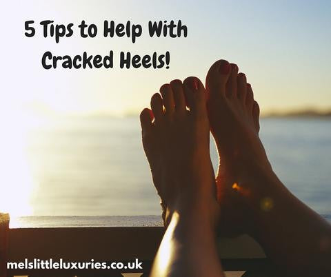 5 Tips to Help With Cracked Heels!